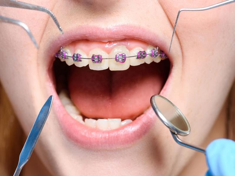 Como a odontologia evoluiu– Parte I