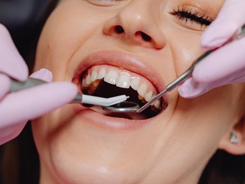 10 Motivos para visitar o dentista regularmente