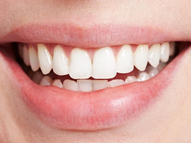 Prótese Dentária em Sessão Única: Como Funciona essa Tecnologia Inovadora