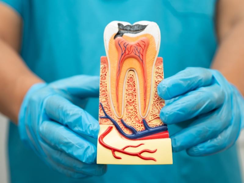 Tratamento de Canal com Microscopia: Por que essa Tecnologia faz Diferença?